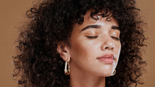 A woman showing Melasma on her face