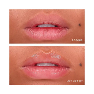 Anfisa ÂN-GLOSS Ceramide Lip Treatment