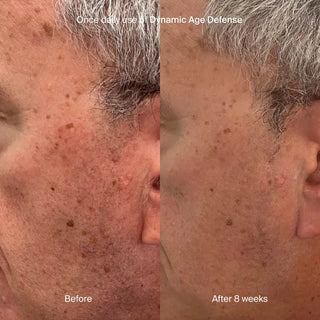 Pavise Dynamic Age Defense