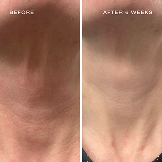 SkinCeuticals AGE Interrupter Ultra Serum